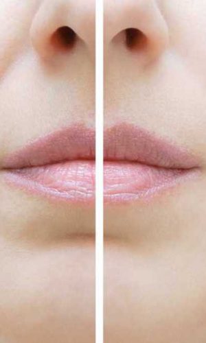 BVFP4RJEV5CQTCLAA7SVSUKOTY