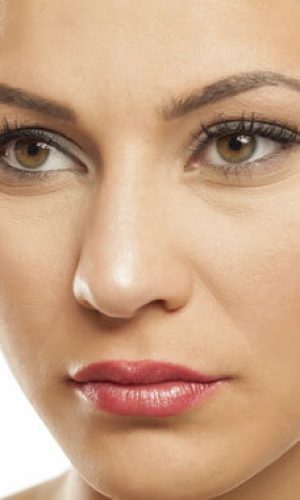 flacidez-facial-quito