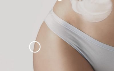 lipolisis-laser-mujer-aplicando-crema