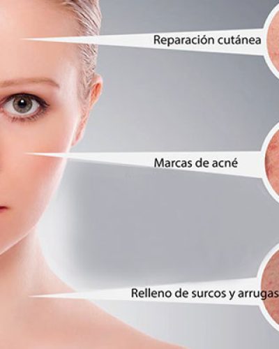 plasma-rico-en-plaquetas-santa-marta