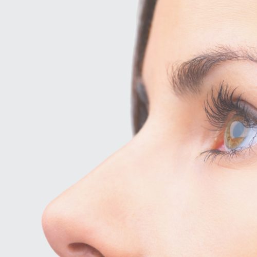 rinoplastia-bogota-1